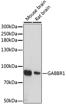 Anti-GABBR1 Antibody (CAB10504)