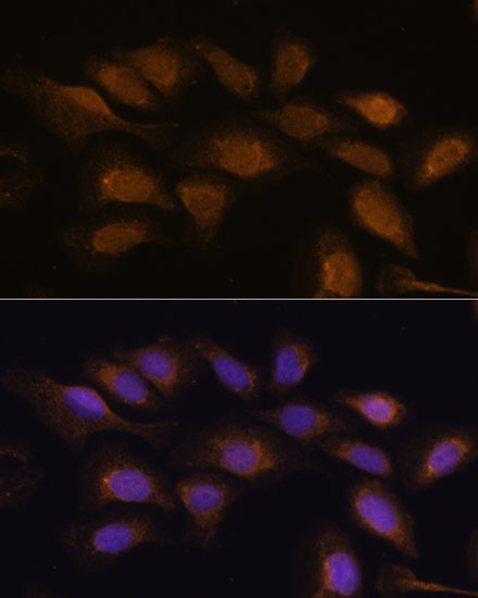 Anti-RPS6KA2 Antibody (CAB16305)