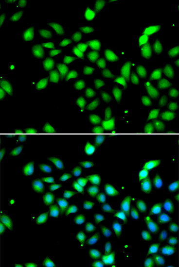 Anti-METTL13 Antibody (CAB12582)