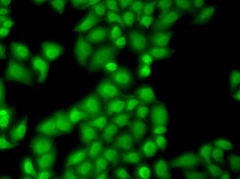 Anti-GTF2F1 Antibody (CAB2489)