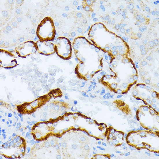 Anti-IL-3RA Antibody (CAB3926)