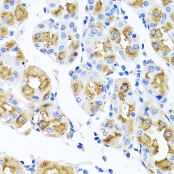 Anti-FECH Polyclonal Antibody (CAB8418)