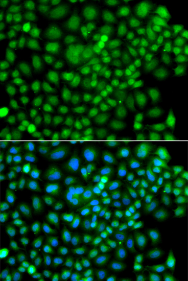 Anti-SUMO4 Antibody (CAB7517)