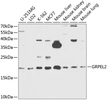 Anti-GRPEL2 Polyclonal Antibody (CAB8339)