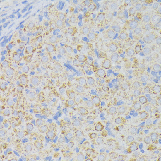 Anti-ACADL Antibody (CAB1266)