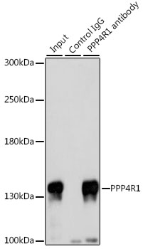 Anti-PPP4R1 Polyclonal Antibody (CAB8361)