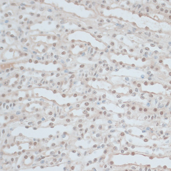 Anti-ZNF562 Antibody (CAB14901)