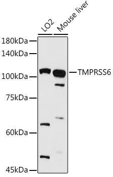 Western blot analysis of extracts of various cell lines, using TMPRSS6 antibody at 1:1000 dilution. Secondary antibody: HRP Goat Anti-Rabbit IgG (H+L) at 1:10000 dilution. Lysates/proteins: 25ug per lane. Blocking buffer: 3% nonfat dry milk in TBST. Detection: ECL Basic Kit. Exposure time: 90s.