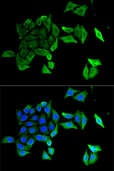 Anti-EFNB2 Antibody (CAB5669)