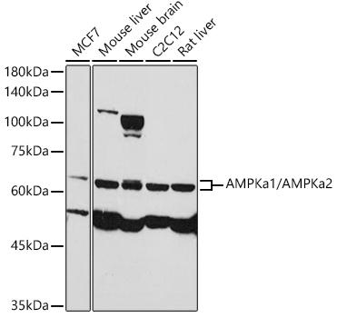 Western blot analysis of extracts of various cell lines, using AMPKa1/AMPKa2 antibody at 1:1000 dilution. Secondary antibody: HRP Goat Anti-Rabbit IgG (H+L) at 1:10000 dilution. Lysates/proteins: 25ug per lane. Blocking buffer: 3% nonfat dry milk in TBST. Detection: ECL Basic Kit. Exposure time: 90s.