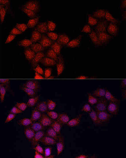 Anti-Apoe Antibody (CAB16344)