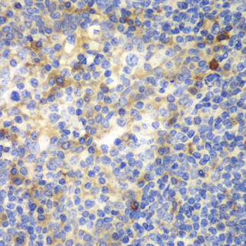 Anti-ZAP70 Antibody (CAB2195)