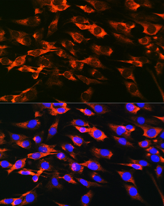 Anti-SERPINA3 Antibody (CAB2803)