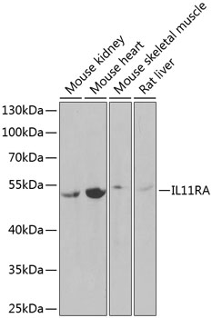 Anti-IL-11RA Antibody (CAB6627)