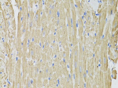 Anti-FHIT Antibody (CAB1196)