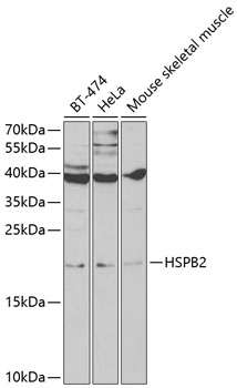 Anti-HSPB2 Antibody (CAB2350)