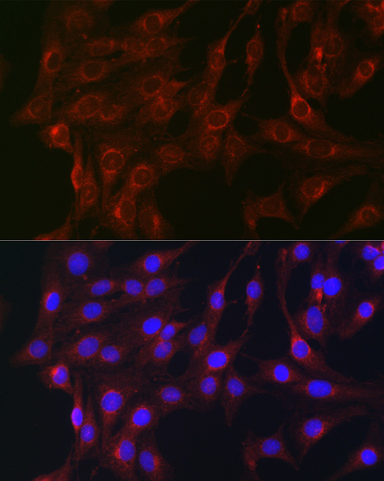 Anti-RAB1B Antibody (CAB7514)