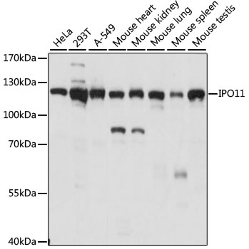 Anti-IPO11 Antibody (CAB14680)