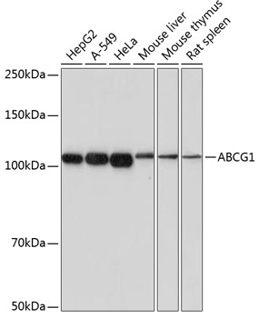 Anti-ABCG1 Rabbit Monoclonal Antibody (CAB17907)