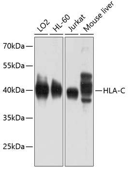 Anti-HLA-C Antibody (CAB1013)