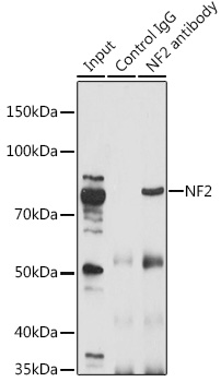 Anti-NF2 Antibody [KO Validated] (CAB13626)