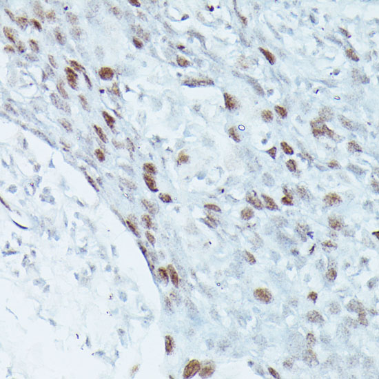 Anti-MEF2C Antibody (CAB2585)