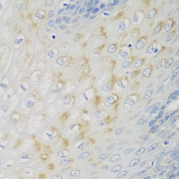 Anti-NME4 Polyclonal Antibody (CAB8350)