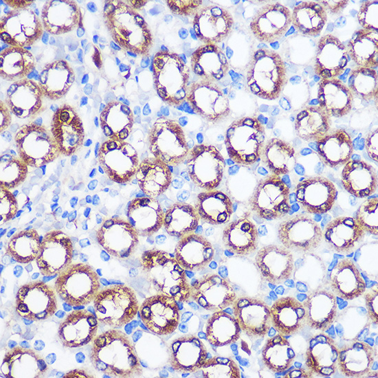 Anti-BMP7 Antibody (CAB0697)