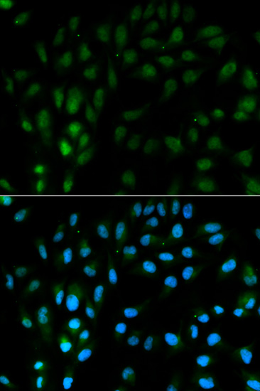 Anti-TFPI Antibody (CAB1624)