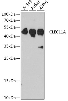 Anti-CLEC11A Antibody (CAB3634)