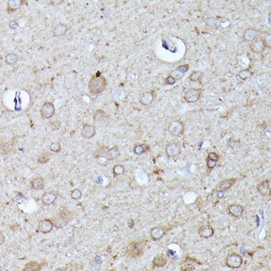 Anti-N-WASP Antibody (CAB2576)