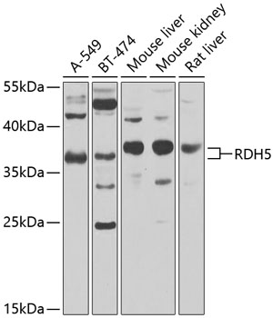 Anti-RDH5 Polyclonal Antibody (CAB8055)