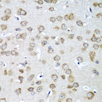 Anti-EIF1AX Antibody (CAB5917)