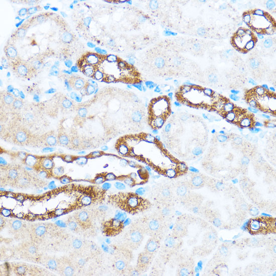 Anti-PIK3CA Antibody (CAB0265)