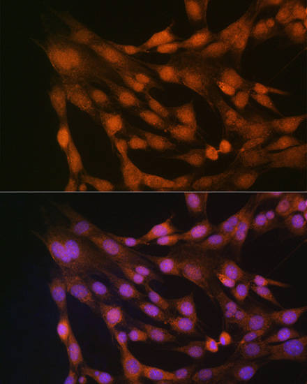 Anti-TXN Antibody (CAB0053)