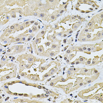 Anti-SP110 Antibody (CAB14003)