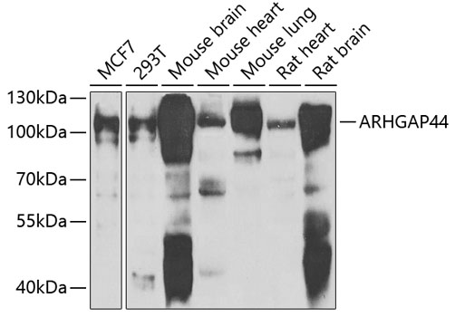 Anti-ARHGAP44 Antibody (CAB7357)