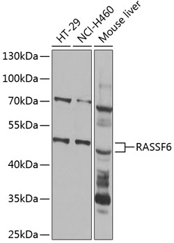 Anti-RASSF6 Antibody (CAB14163)