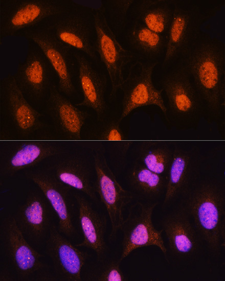 Anti-HSPA2 Antibody (CAB7902)