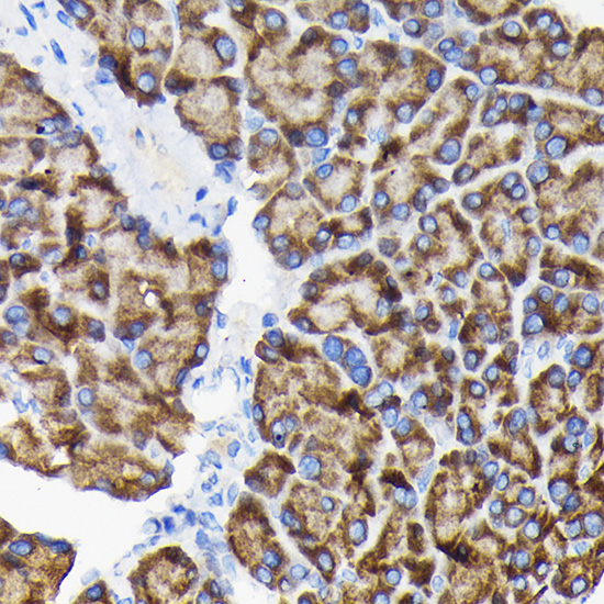 Anti-RPS3 Antibody (CAB2533)