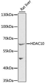 Anti-HDAC10 Antibody (CAB6184)