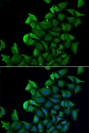 Anti-FABP5 Antibody (CAB6373)