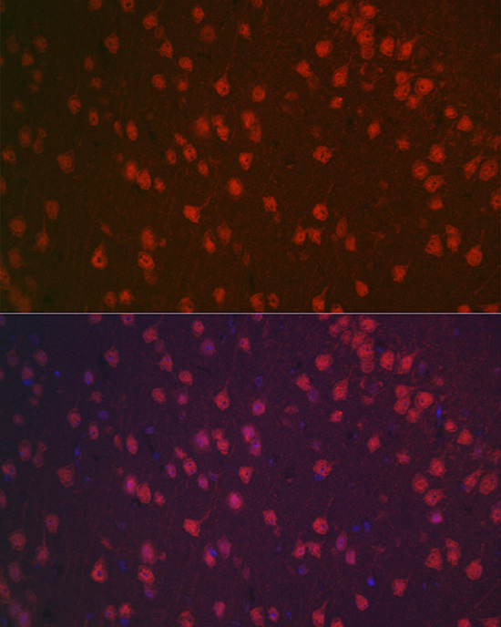 Anti-NeuN Antibody [KO Validated] (CAB0951)