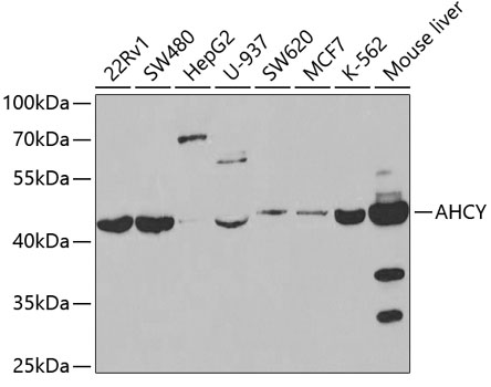 Anti-AHCY Antibody (CAB5300)