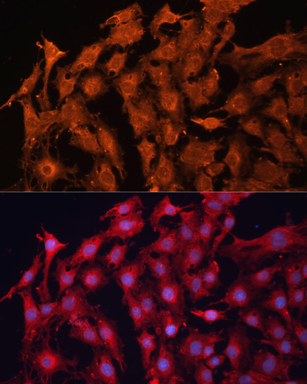 Anti-P Glycoprotein Antibody (CAB1284)