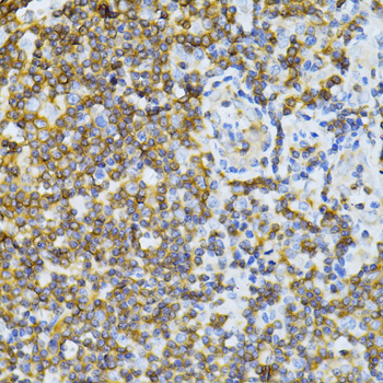 Anti-MT-ND5 Antibody (CAB12465)