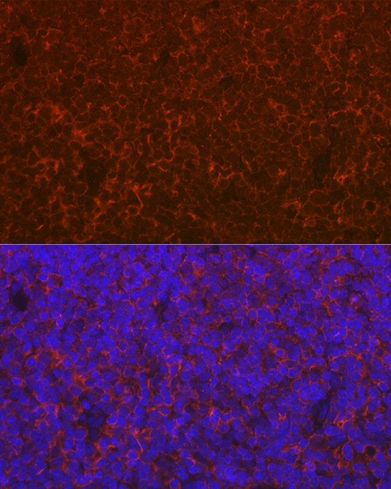 Anti-CD69 Antibody (CAB2045)