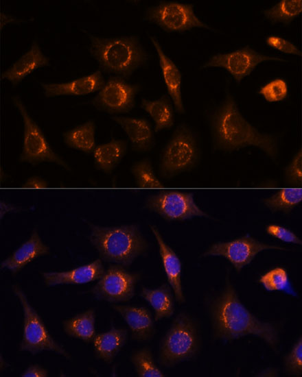 Anti-NUCB1 Antibody [KO Validated] (CAB3994)