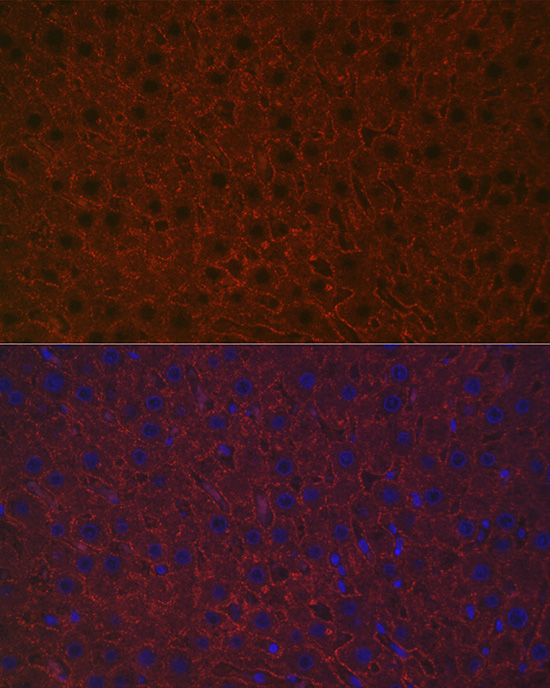 Anti-ASGR1 Antibody (CAB13279)