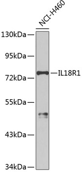 Anti-IL-18R1 Antibody (CAB2706)